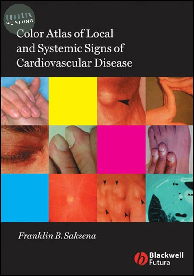 Color Atlas of Local and Systemic Manifestations of Cardiovascular Disease 