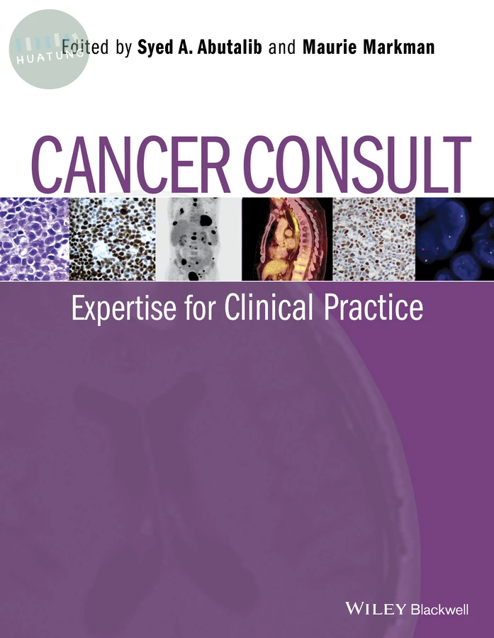 Cancer Consult 