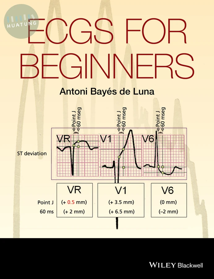 ECGs for Beginners 