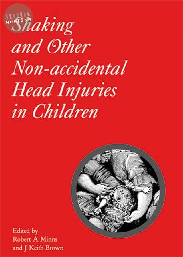 Shaking and Other Non-Accidental Head Injuries in Children 