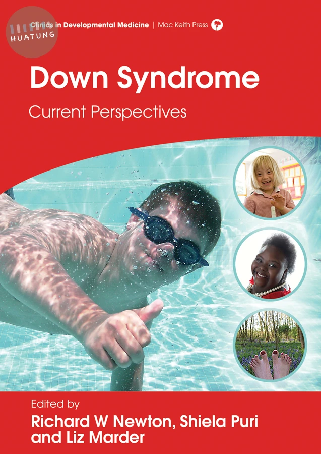 Down Syndrome 