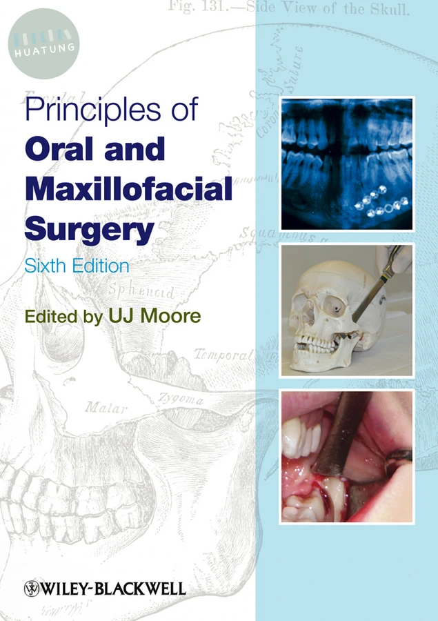 Principles of Oral and Maxillofacial Surgery 