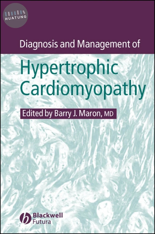 Diagnosis and Management of Hypertrophic Cardiomyopathy 
