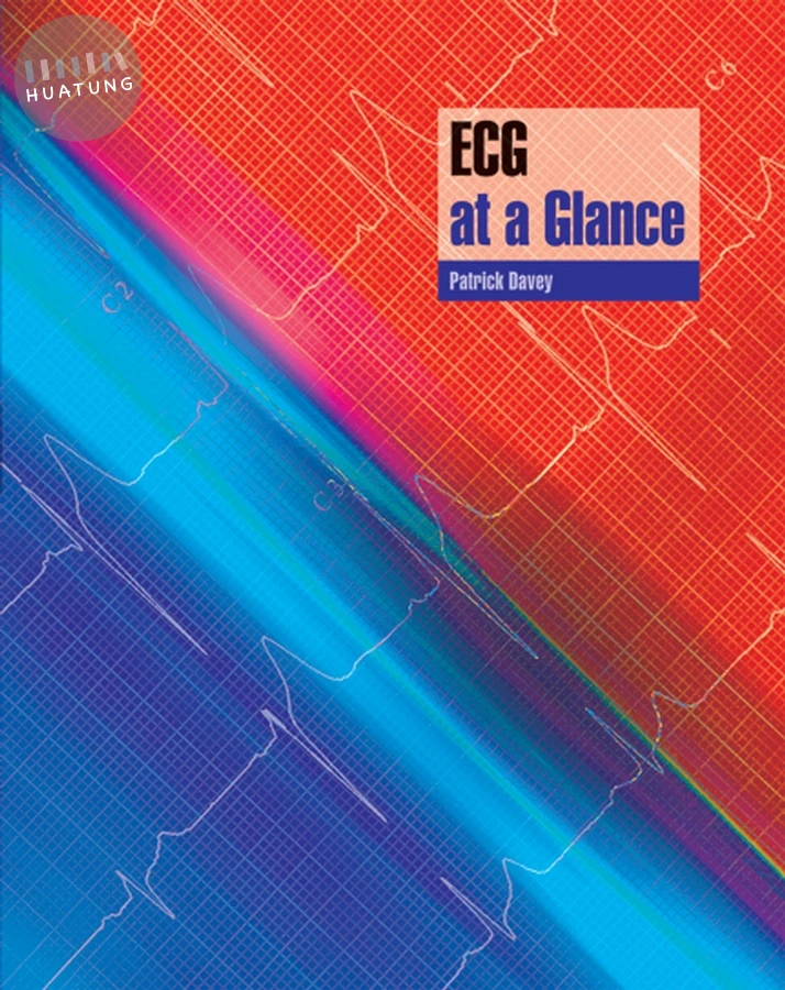 ECG at a Glance 