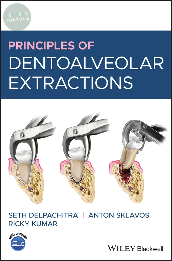 Principles of Dentoalveolar Extractions 