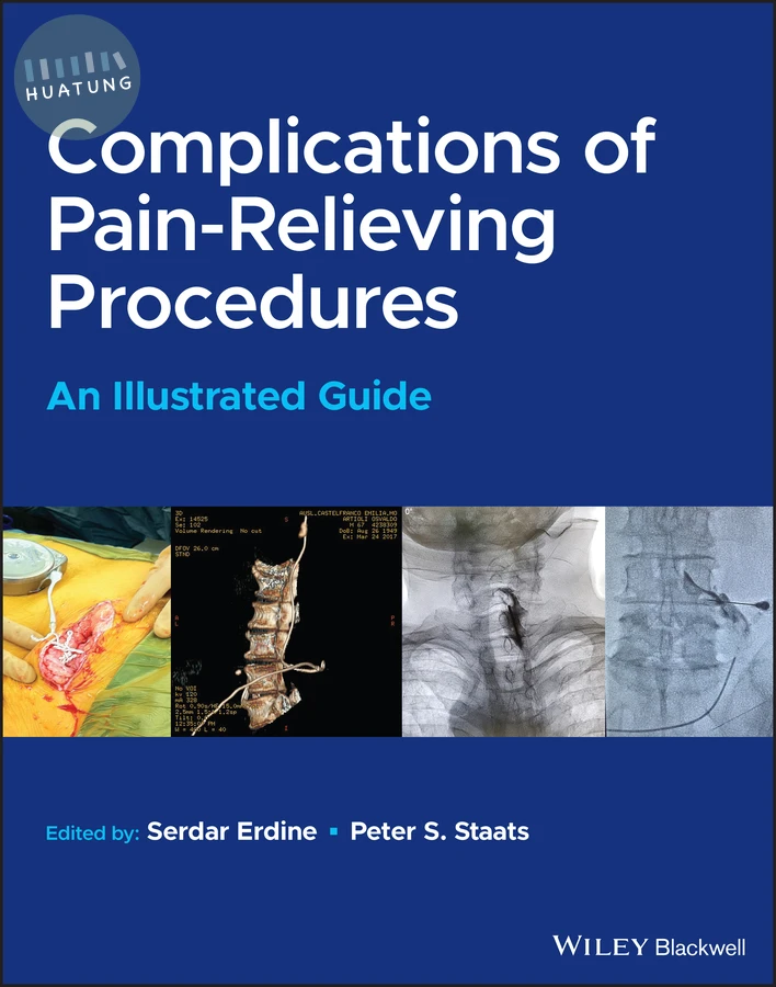 Complications of Pain-Relieving Procedures 