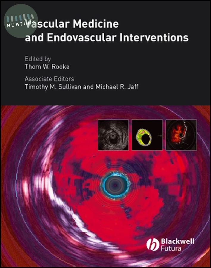 Vascular Medicine and Endovascular Interventions 