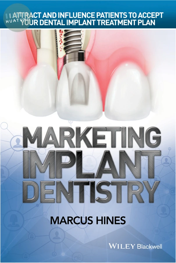 Marketing Implant Dentistry 