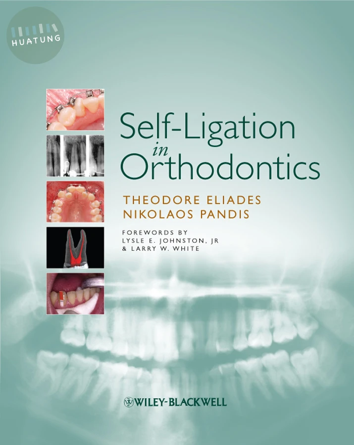 Self-Ligation in Orthodontics 