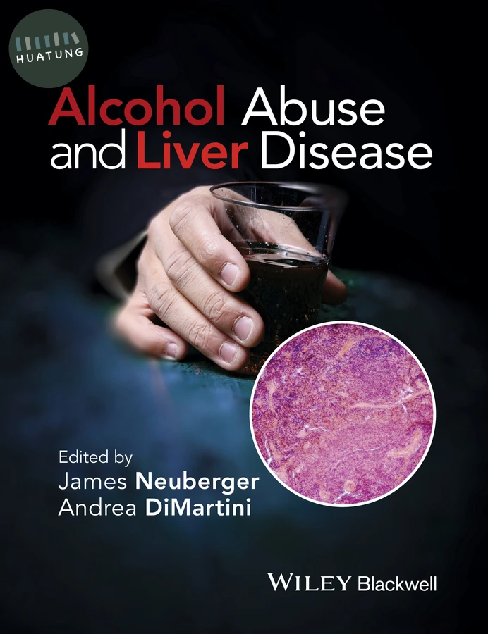 Alcohol Abuse and Liver Disease 