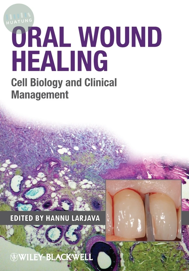 Oral Wound Healing 