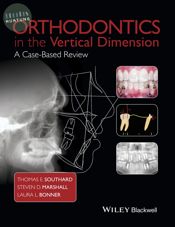 Orthodontics in the Vertical Dimension 