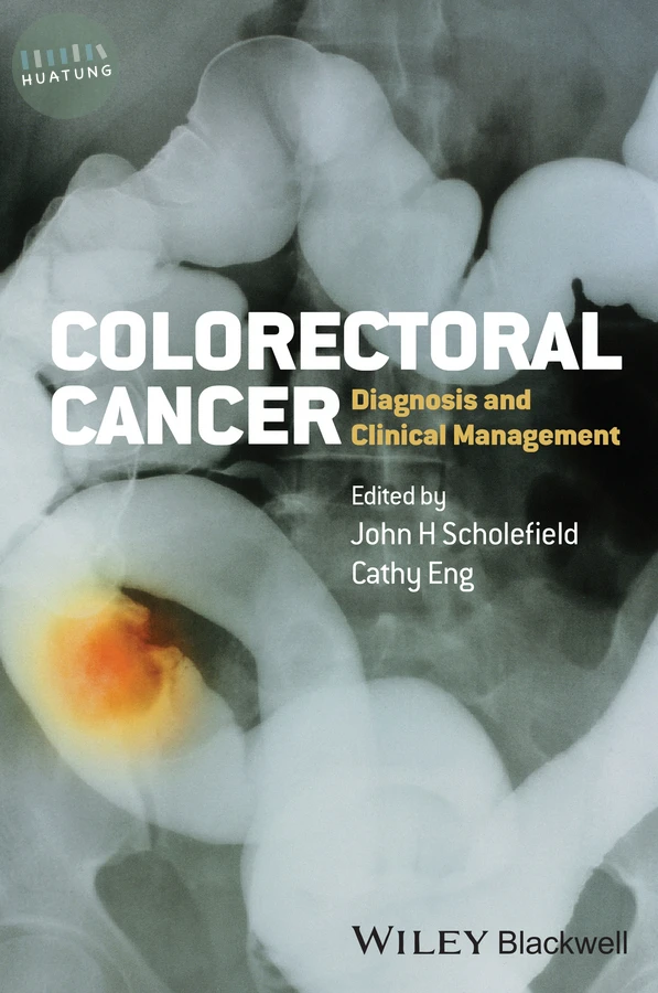 Colorectal Cancer 