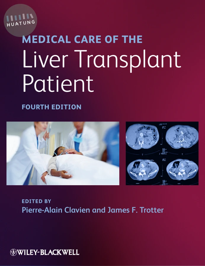 Medical Care of the Liver Transplant Patient 