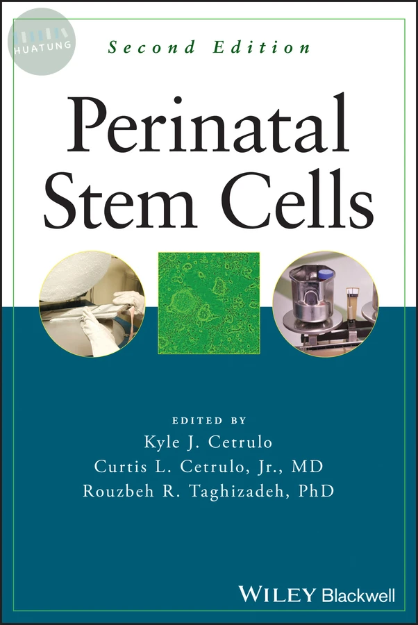 Perinatal Stem Cells 