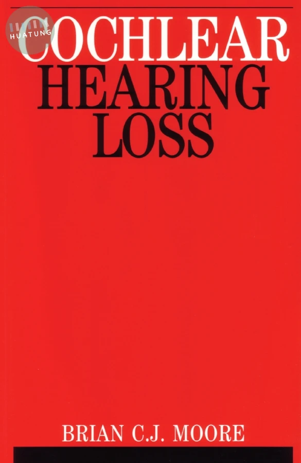 Cochlear Hearing Loss 