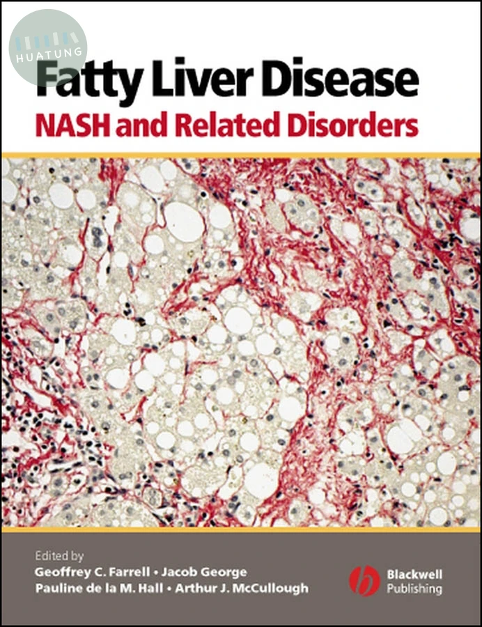 Fatty Liver Disease 