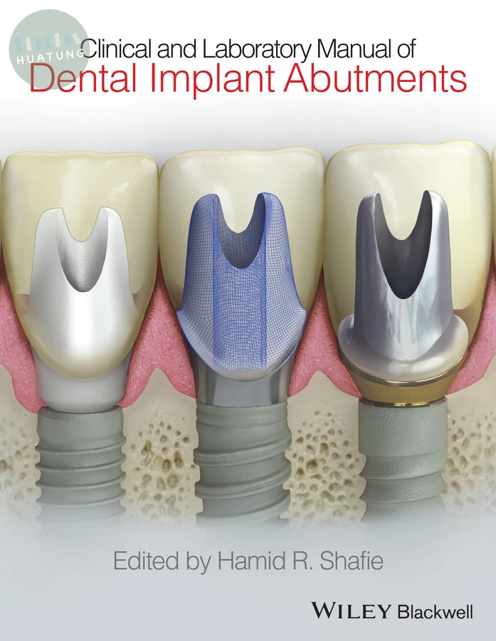 Clinical and Laboratory Manual of Dental Implant Abutments 