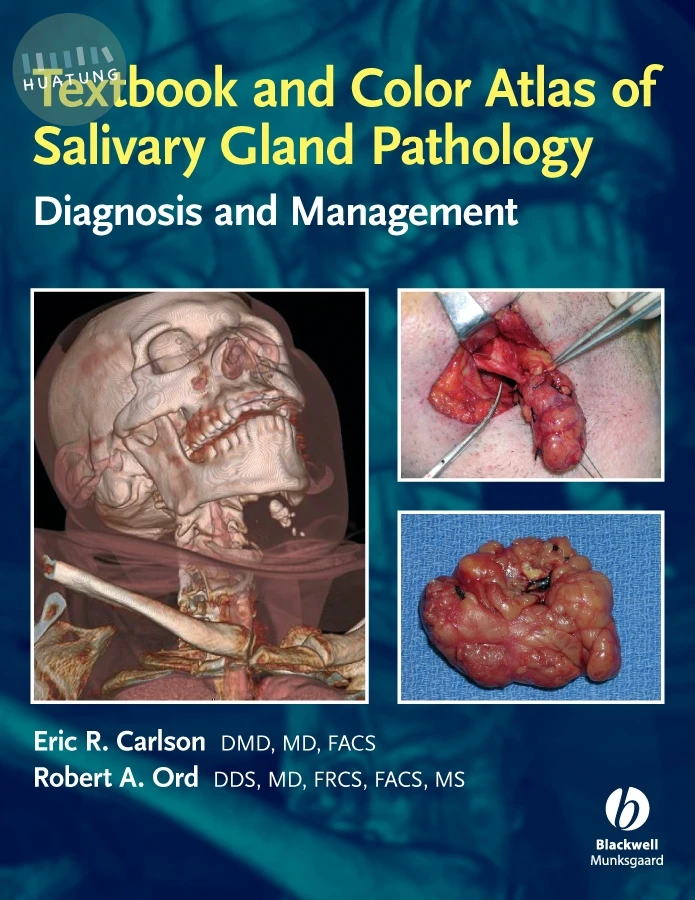 Textbook and Color Atlas of Salivary Gland Pathology 