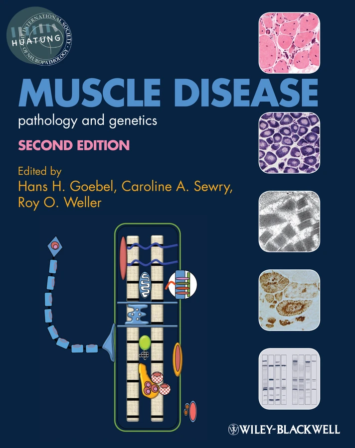 Muscle Disease 