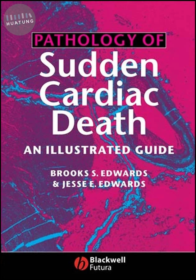 Pathology of Sudden Cardiac Death 