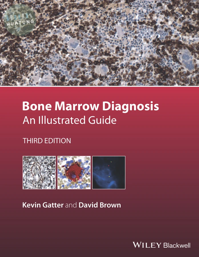 Bone Marrow Diagnosis 