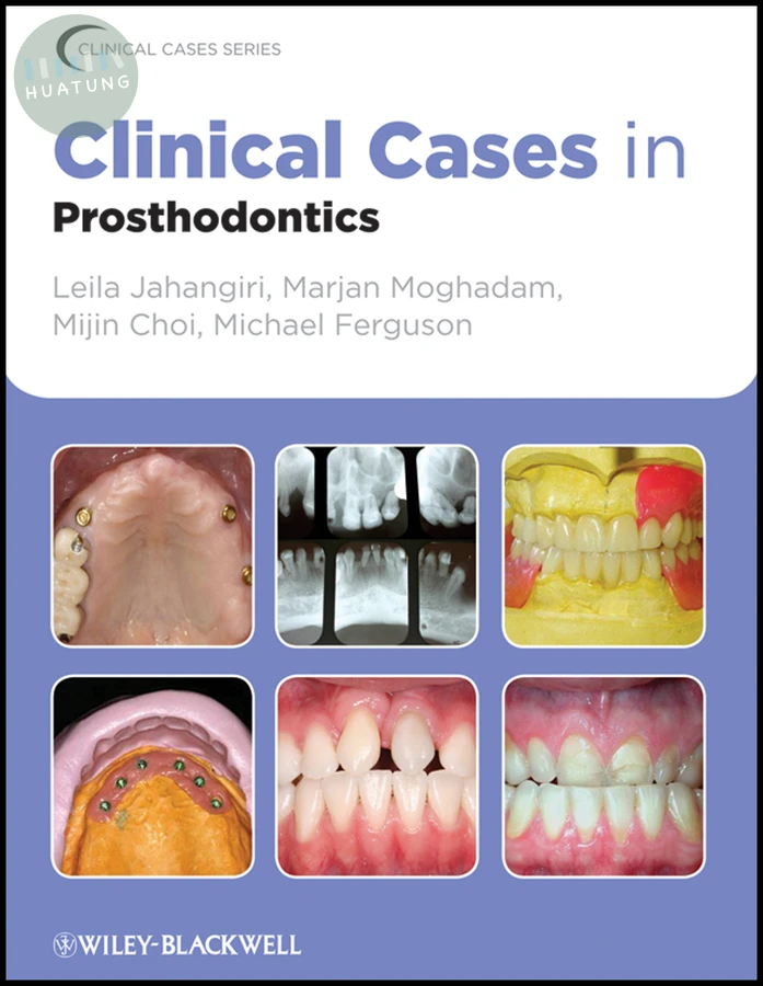 Clinical Cases in Prosthodontics 