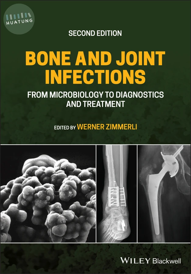 Bone and Joint Infections 