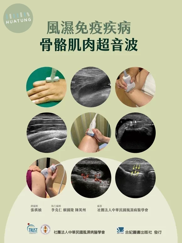 風濕免疫疾病骨骼肌肉超音波 (1版)