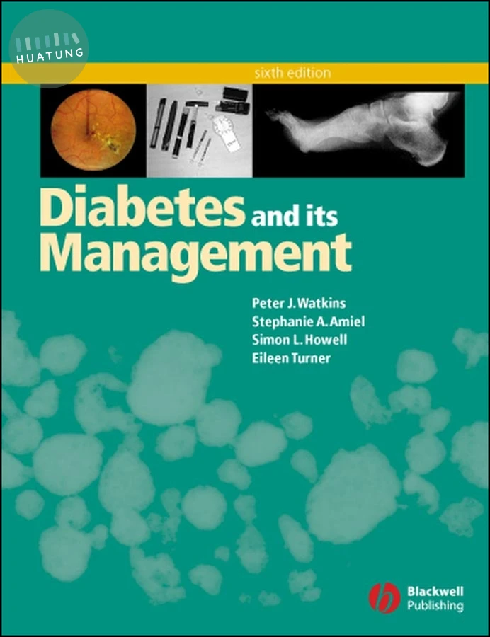 Diabetes and Its Management 