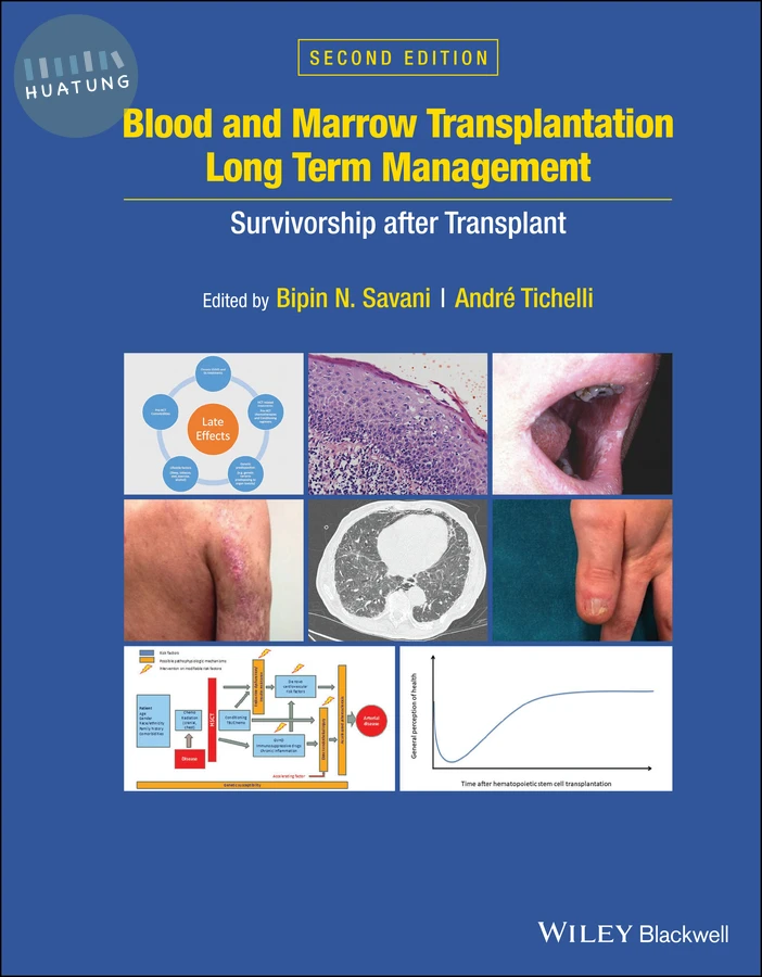 Blood and Marrow Transplantation Long Term Management 