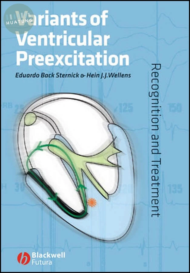 Variants of Ventricular Preexcitation 