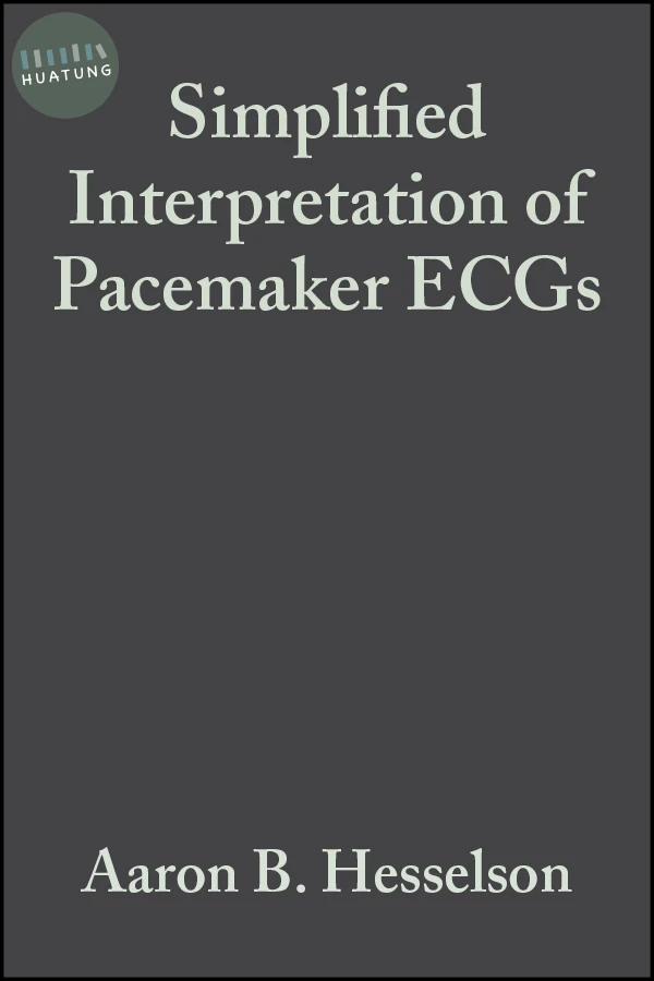Simplified Interpretation of Pacemaker ECGs 