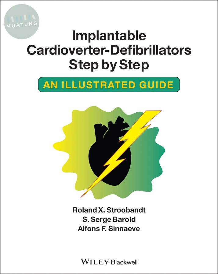 Implantable Cardioverter - Defibrillators Step by Step 
