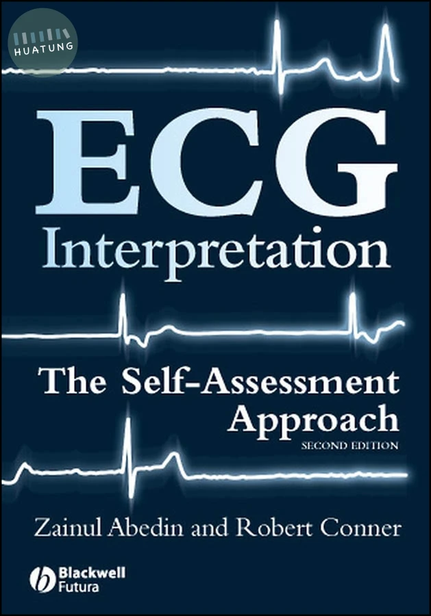 ECG Interpretation 