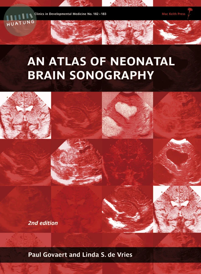 An Atlas of Neonatal Brain Sonography 