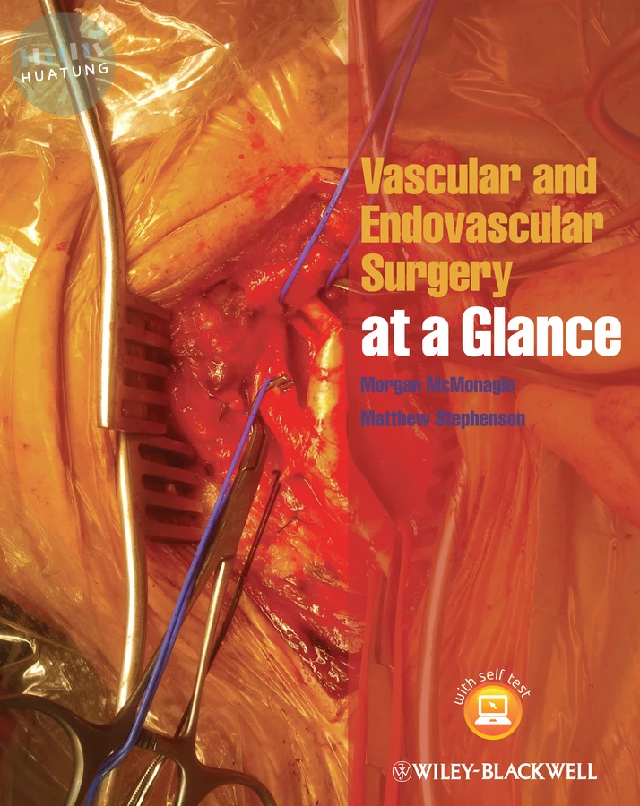Vascular and Endovascular Surgery at a Glance 