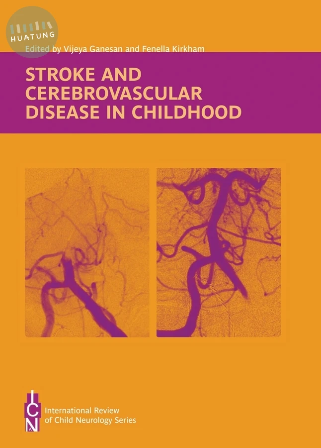 Stroke and Cerebrovascular Disease in Childhood 