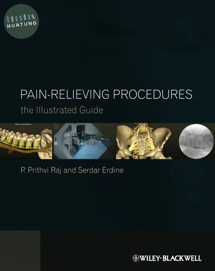 Pain-Relieving Procedures 