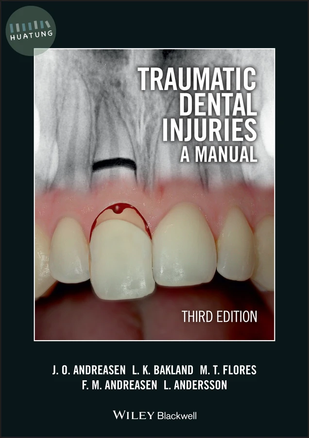 Traumatic Dental Injuries 
