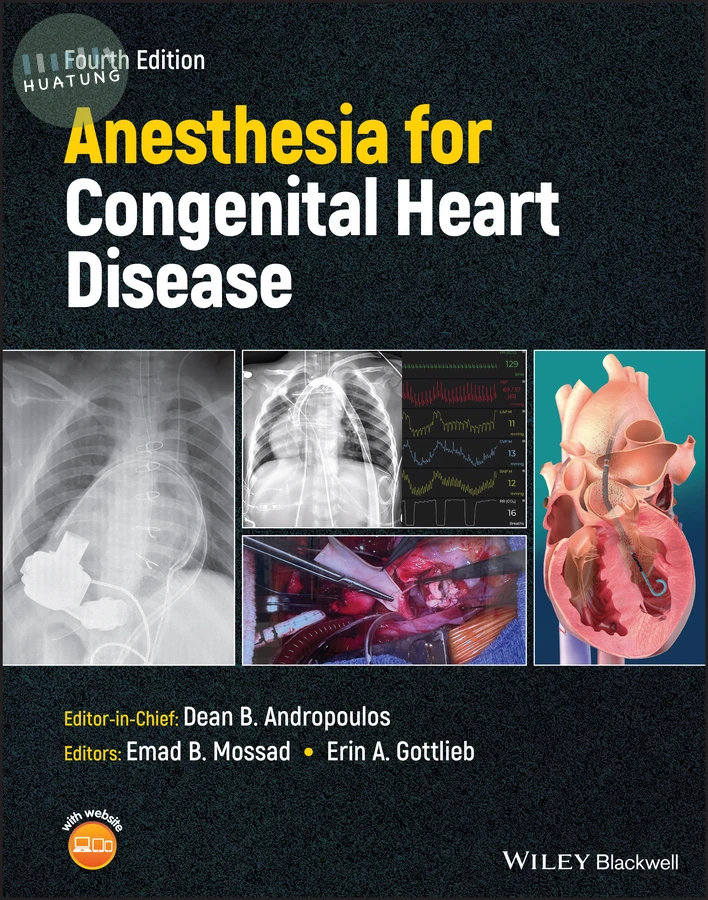 Anesthesia for Congenital Heart Disease 