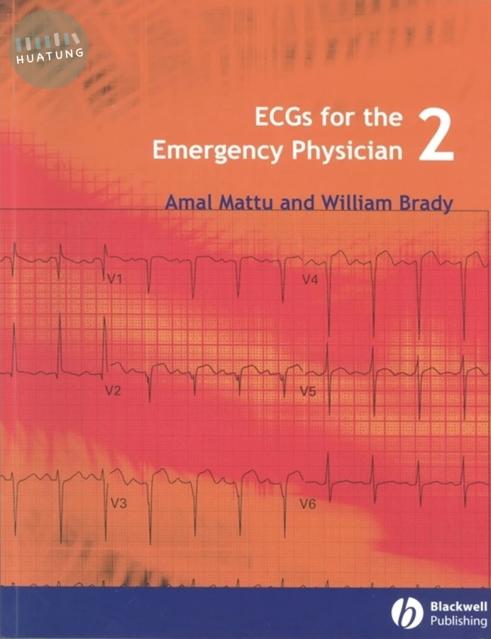 ECGs for the Emergency Physician 2 