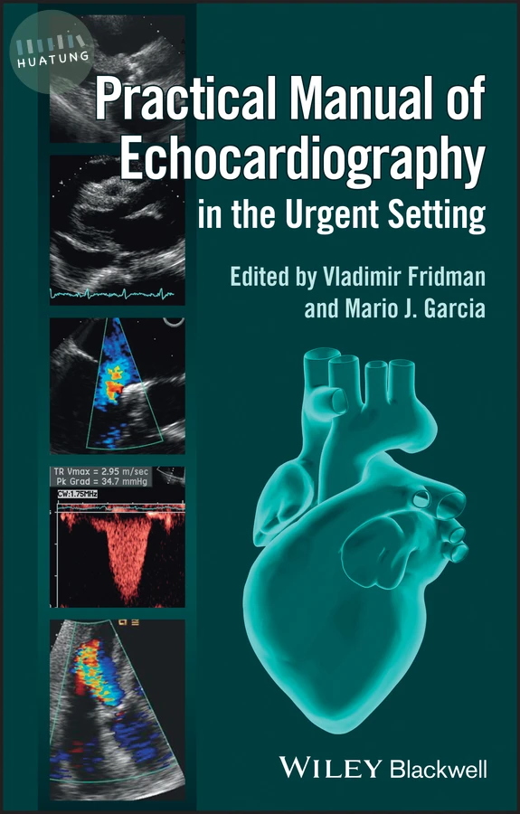 Practical Manual of Echocardiography in the Urgent Setting 