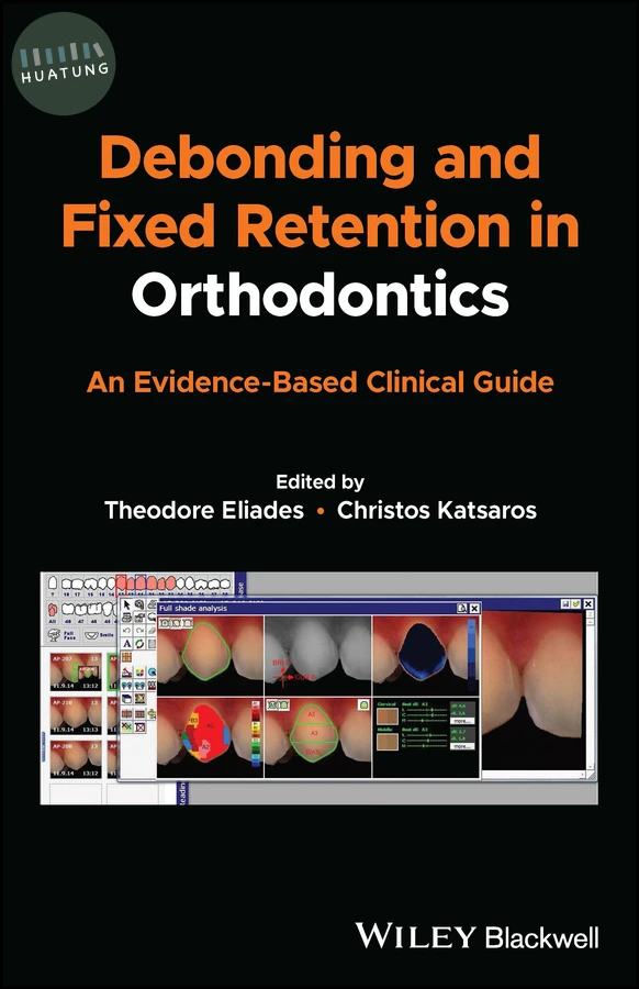 Debonding and Fixed Retention in Orthodontics 