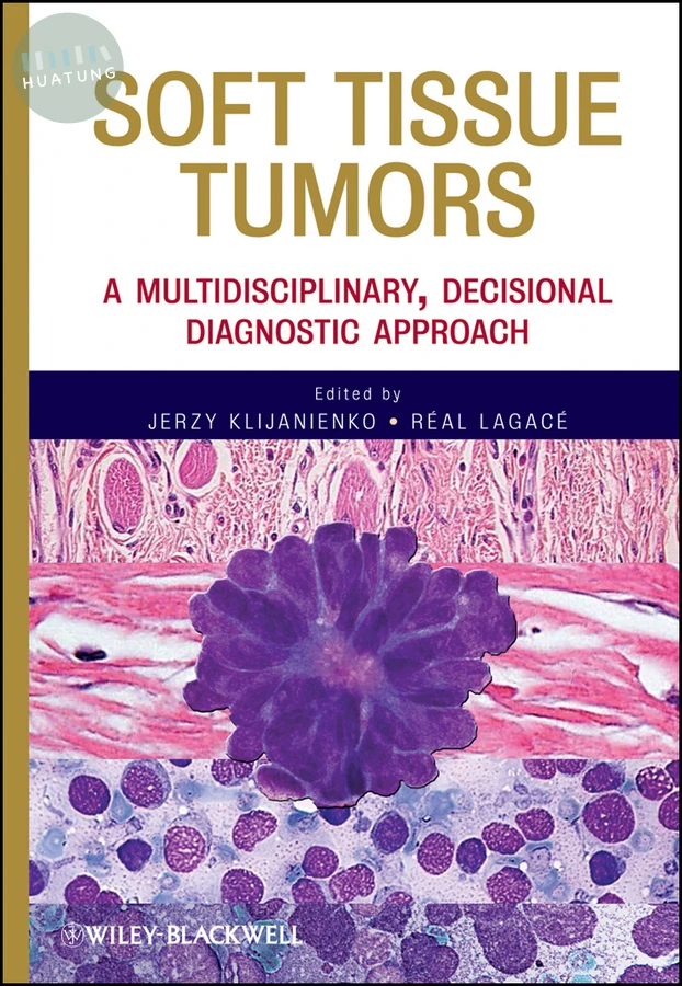 Soft Tissue Tumors 