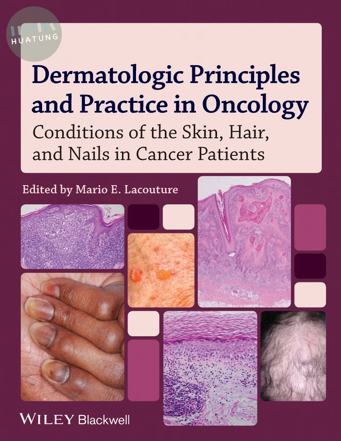Dermatologic Principles and Practice in Oncology 