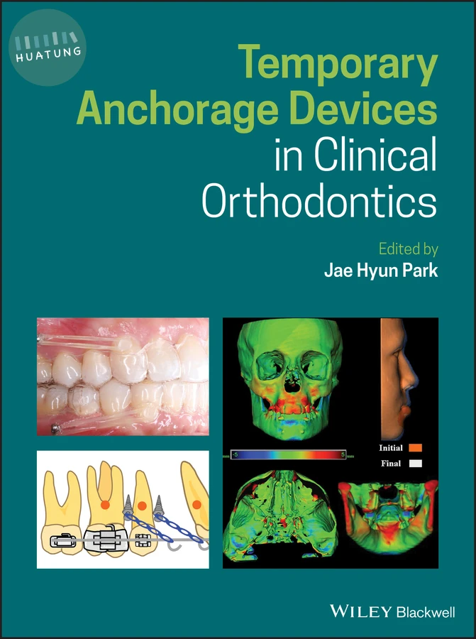 Temporary Anchorage Devices in Clinical Orthodontics 