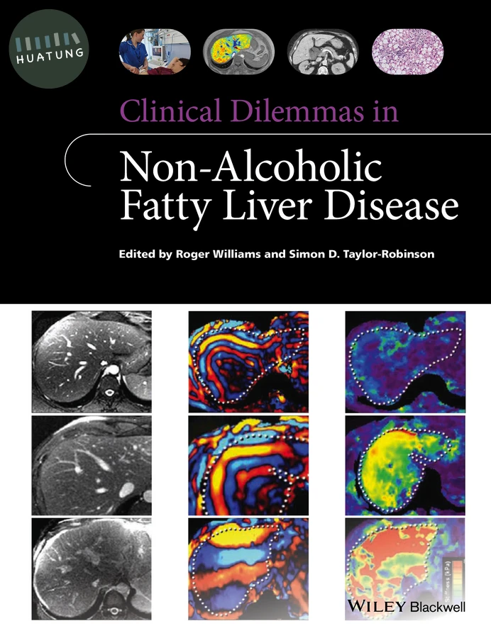 Clinical Dilemmas in Non-Alcoholic Fatty Liver Disease 