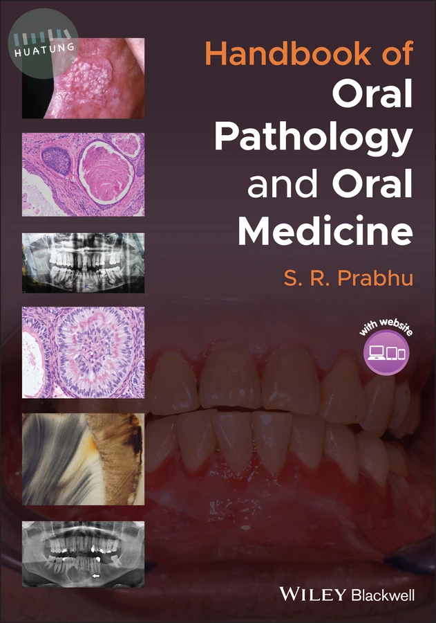 Handbook of Oral Pathology and Oral Medicine 