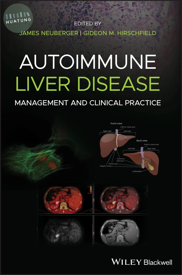 Autoimmune Liver Disease 